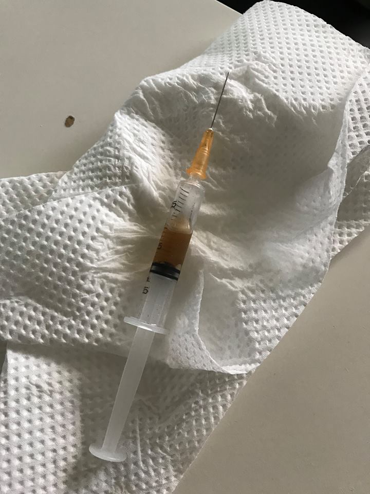 Sprautunál með óþekktum vökva fannst hjá KA-vellinum Sprautunál með óþekktum vökva fannst hjá KA-vellinum