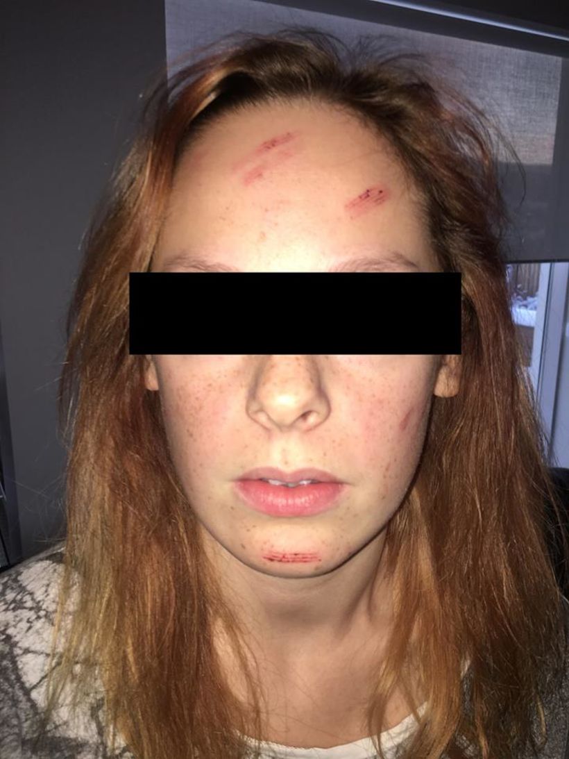 Móðir stúlkunnar sem keyrt var á hvetur ökumanninn til að gefa sig fram Móðir stúlkunnar sem keyrt var á hvetur ökumanninn til að gefa sig fram