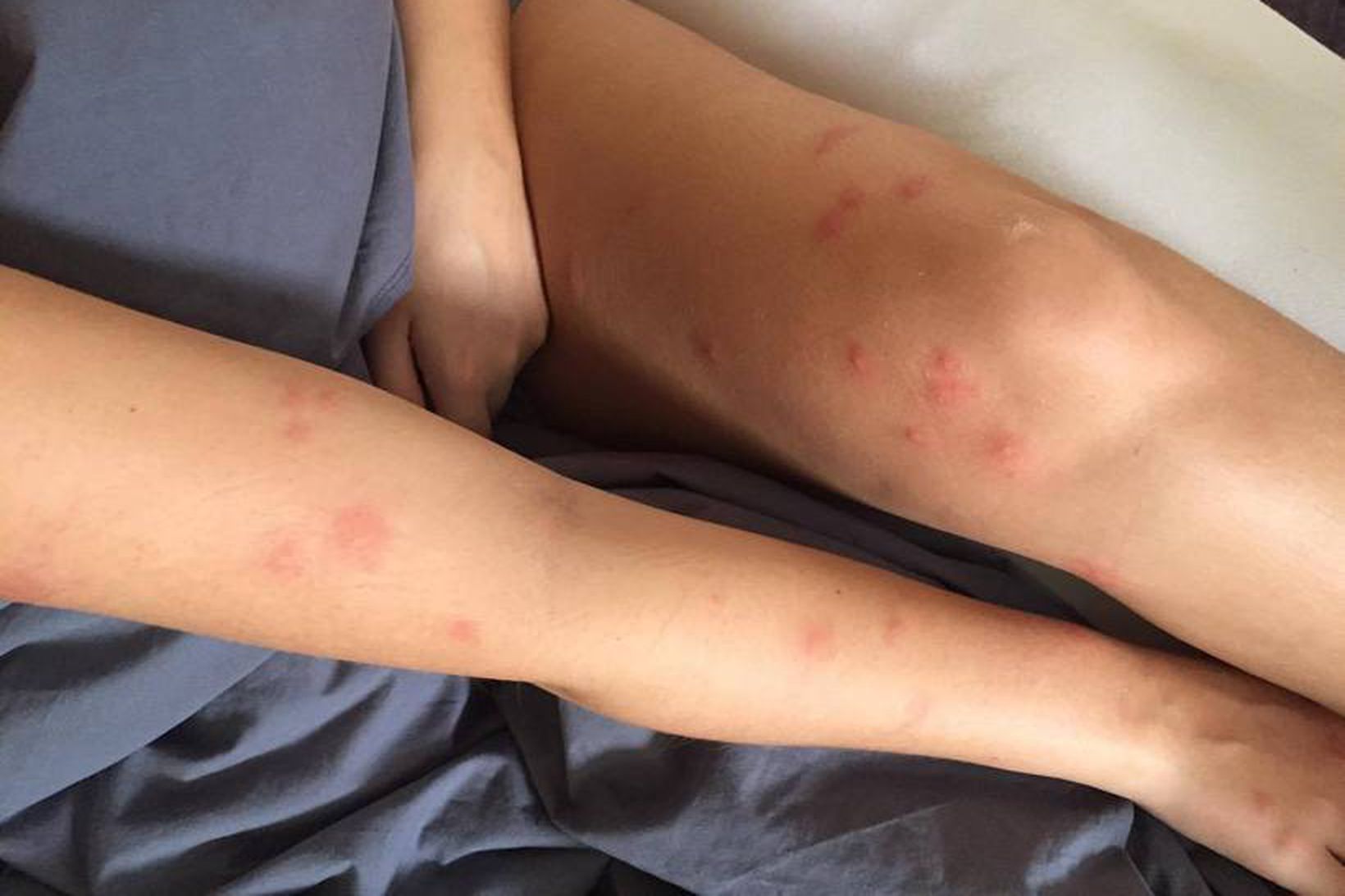 Lúsmý herjar á Norðurland